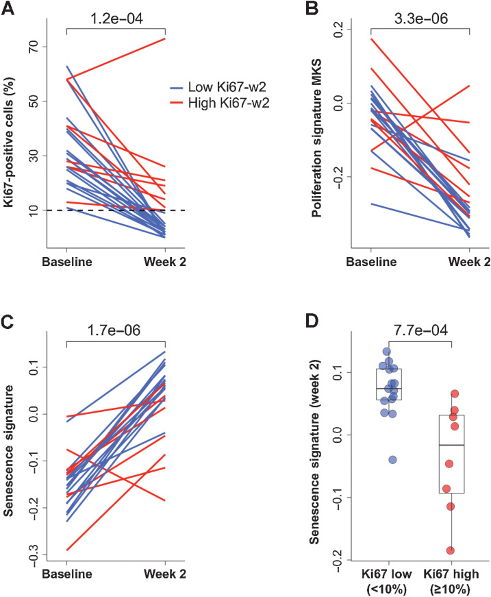 Figure 5. Proliferation markers and senescence at week 2 in NA-PHER2 patients. A, Individual dynamic, from baseline to week 2, of Ki67-positive cells (%) detected by IHC in patients (n = 22) treated with palbociclib, fulvestrant, trastuzumab, and pertuzumab (PFHPert). Dashed line represents the cut-off to classify patients with low Ki67-w2 (<10% blue line) or high Ki67-w2 (> = 10% red line). P value was assessed by Wilcoxon paired test (two-tailed). B, The proliferation signature MKS was tested in RNA-seq data from paired tumor core-biopsies obtained pretreatment and at day 14 (n = 22). Data are expressed as dynamic score for individual patients stratified for low (blue line) and high (red line) Ki67-w2. P value was by Wilcoxon paired test (two-tailed). C, Relationship between Ki67 and senescence gene signature expression during treatment with PFHPert. The dynamics, from baseline to week 2, of the Senescence Signature is reported for patients showing a low (blue line) or high (red line) Ki67-w2. P value by Wilcoxon paired test (two-tailed). D, Box plot described the correlation between Senescence Signature score at week 2 and level of Ki67 measured at week 2 in the two patient subgroups low Ki67-w2 (blue circles) and high Ki67-w2 (red circles). P value was by Wilcoxon unpaired test (two-tailed).