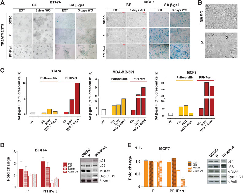 Figure 3. Senescence. A, Study of the senescence-like phenotype in HER2+ BT474 cell line, and in HER2low MCF7 cell line. The effects of treatments with palbociclib and PFHPert were studied at EOT (72 hours) and after additional 3 days of WO with fresh medium. Morphologic changes after WO were shown in BF images on the left-sided panels. In the right-sided panels the SA β-gal enzyme activation in the same conditions was shown. For the complete panel of treatments in BT474, MCF7, and MDA-MB-361 see Supplementary Fig. S6. B, Representative images of morphologic changes in MCF7 cell treated with palbociclib for 72 hours. C, Evaluation of SA β-gal activation at baseline (untreated cells), during (6 hours), at the end (EOT), and after treatment (3 days WO) in BT474 (graph on the left), MDA-MB-361 (graph on the middle), and MCF7 (graph on the right). The comparison between untreated cells (white bars), palbociclib alone (yellow bars), and PFHPert (red bars) was reported. Staining was performed with a colorimetric kit and detection of % of SA β-gal–positive cells was evaluated by Amnis Image Stream Flow Cytometry Technology (Merck). Modulation of p53-p21-MDM2 axis and Cyclin D1 during treatment with palbociclib and PFHPert in BT474 (D) and MCF7 (E). Data are from two or three replicates but only one representative blot is showed. Values were calculated after correction for the loading marker and normalization by the control sample in DMSO. Bars represent the mean ± SEM. NT, untreated cells; h, hours.