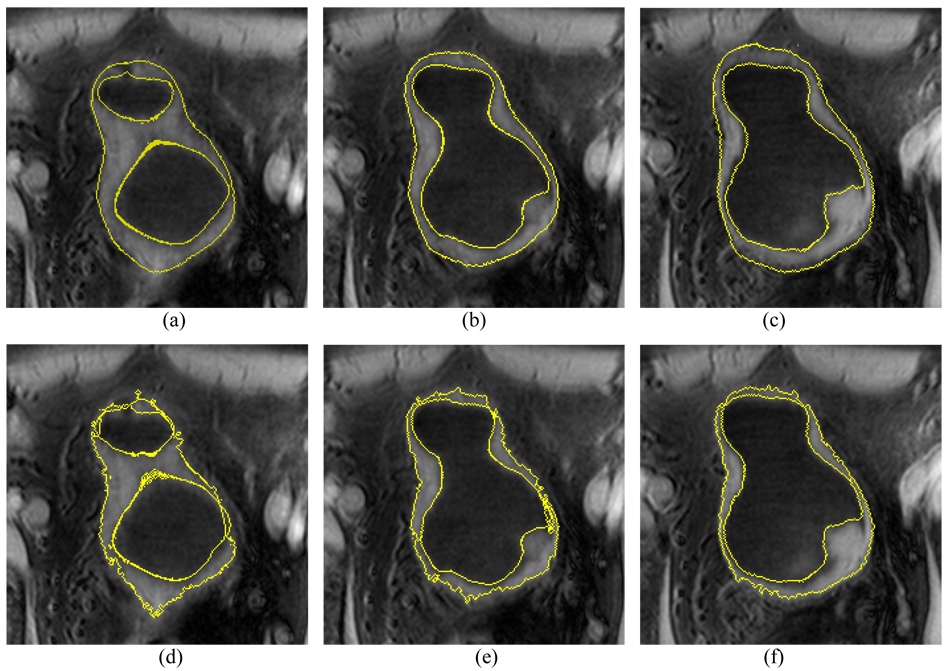 Fig. 13