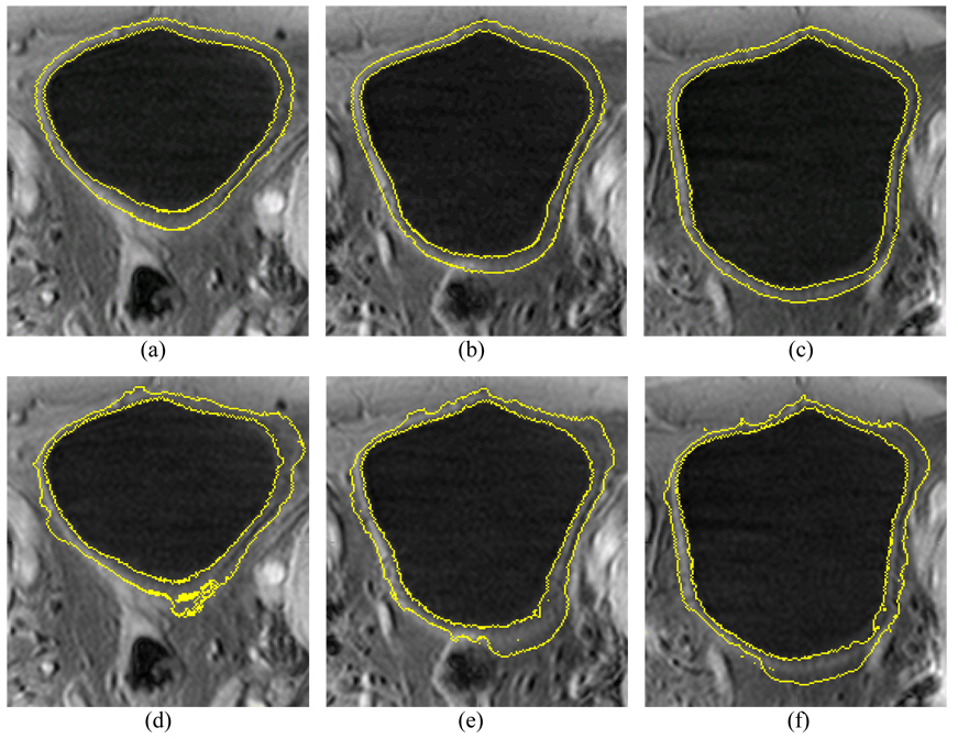 Fig. 12