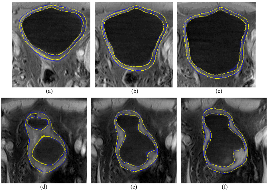 Fig. 16