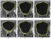 Fig. 12