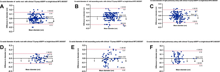 Bland-Altman plots for coaxial diameter measurements of the aortic root, mid ascending aorta, and right pulmonary artery with the clinical native T2prep-bSSFP versus bright-blood MTC-BOOST sequence (A–C) for reviewer 4 (A. Fotaki) and (D–F) for reviewer 2 (K.P.). The black line indicates the mean bias of the diameter measurements, and the red lines represent the 95% CIs. Values are given in centimeters. Measurements from both reviewers showed good agreement between sequences for all three landmarks. MTC-BOOST = Magnetization Transfer Contrast Bright-and-black blOOd phase SensiTive, T2-prep bSSFP = T2-prepared balanced steady-state free precession.