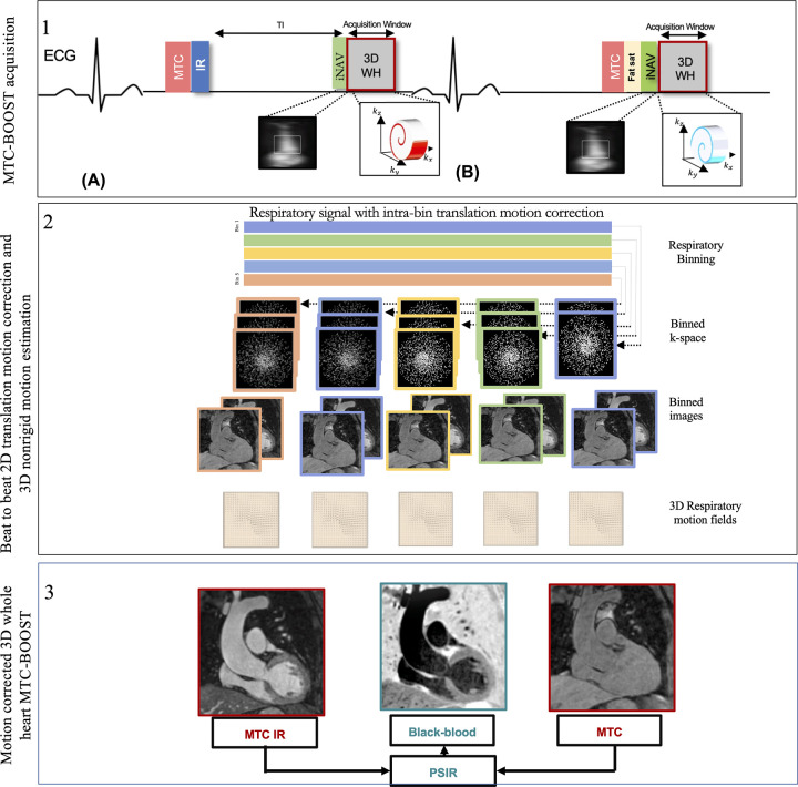 Schematic overview of investigated free-breathing nonrigid motion-corrected three-dimensional (3D) whole-heart MTC-BOOST framework. Top: Two magnetization-prepared bright‐blood volumes are acquired in odd (A) and even (B) heartbeats. Magnetization transfer in combination with an inversion pulse is used in odd heartbeats, whereas magnetization transfer alone is exploited in even heartbeats. In odd heartbeats, a short inversion time inversion-recovery approach is used to suppress the signal from epicardial fat, whereas frequency‐selective presaturation is used in even heartbeats. Data acquisition is performed using a 3D Cartesian trajectory with spiral profile order. A low‐resolution two-dimensional (2D) iNAV is acquired in each heartbeat by spatially encoding the ramp‐up pulses of the bSSFP sequences. The iNAVs are used to estimate foot-head and right-left rigid motion by tracking a template around the aortic arch, providing motion estimates in a beat-to-beat basis. Middle: Foot-head motion is used to sort the 3D MTC-BOOST data into five equally populated bins, and 3D MR images reconstructed at each respiratory position are used to estimate nonrigid motion between bins. 2D translational beat-to-beat and 3D nonrigid bin-to-bin motion is then integrated into an in-line motion-compensated iterative sensitivity encoding reconstruction to produce the final images. Bottom: The bright‐blood MTC‐IR BOOST and MTC-BOOST volumes are corrected for translation and nonrigid motion and are subsequently combined in a PSIR‐like reconstruction to generate a complementary black‐blood volume. bSSFP = balanced steady-state free precession, ECG = electrocardiography, Fat sat = fat suppression, iNAV = image-based navigator, kx = readout, ky = phase encoding, kz = MRI signal along the scanner bore, MTC-BOOST = Magnetization Transfer Contrast Bright-and-black blOOd phase SensiTive, IR = inversion-recovery pulse, PSIR = phase-sensitive inversion recovery, TI = inversion time, 3D WH = 3D whole-heart.