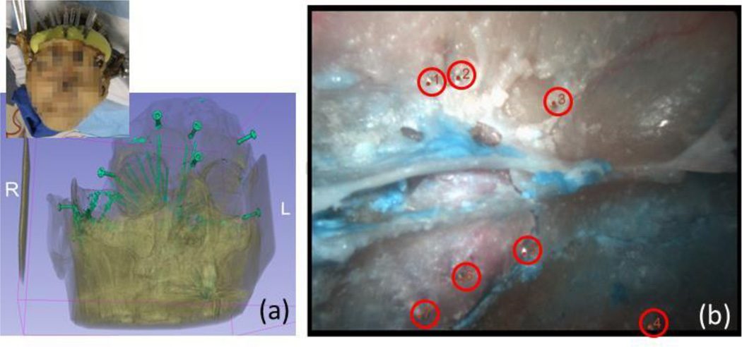 Fig. 3