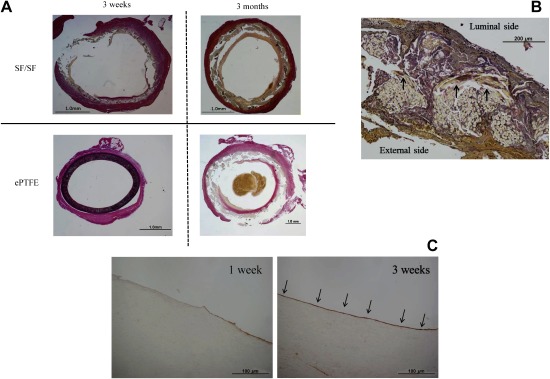 Fig. 3 (A) Histological cross-section image of Elastica van Gieson (EG) staining showing the midsection of each graft at 3 weeks and 3 months post-implantation. (B) Histological cross-section image of EG staining at 3 weeks post-implantation in the silk fibroin (SF) grafts shows SF fiber degradation, and the external SF graft surface was surrounded by a thin connective tissue with collagen fiber replacement in the intraluminal layer (arrows). (C) Histological cross-section image of immunostaining with polyclonal antibody against von Willebrand factor at 3 weeks post-implantation. The luminal layers of the SF grafts were lined with endothelial cells in the midsections of the grafts (arrows).