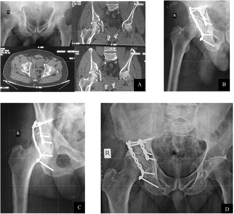 Fig. 2