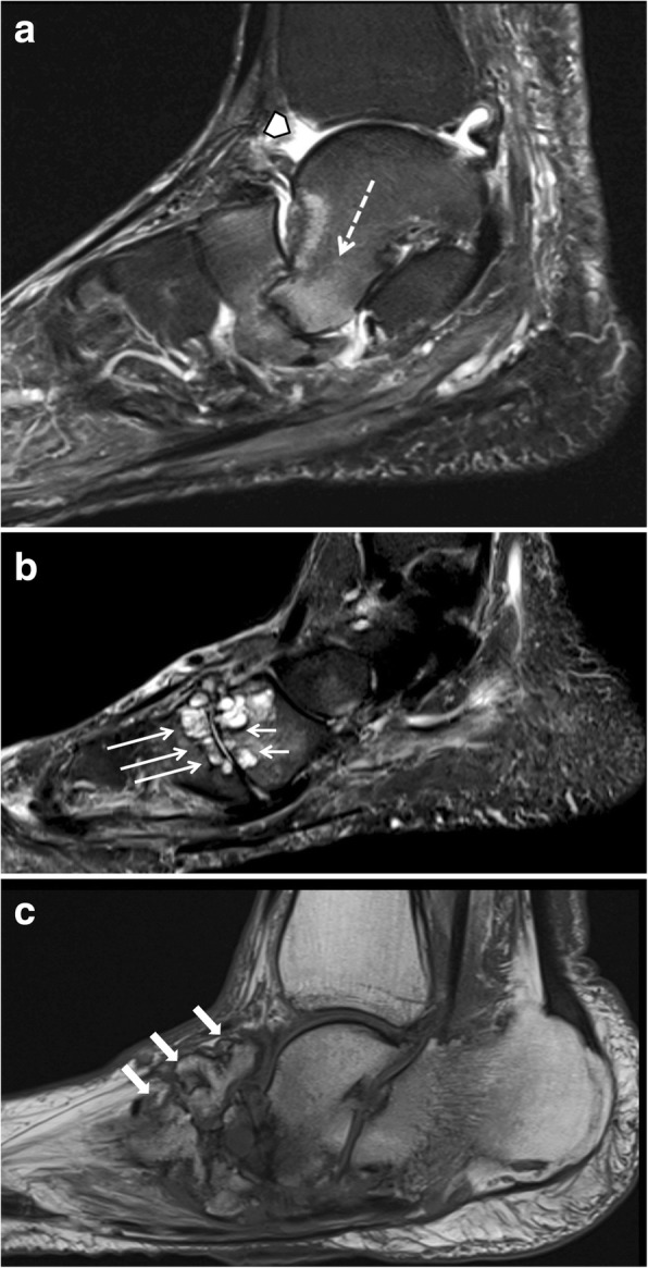 Fig. 17