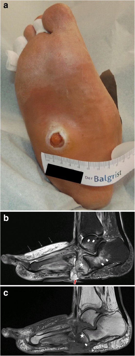 Fig. 20