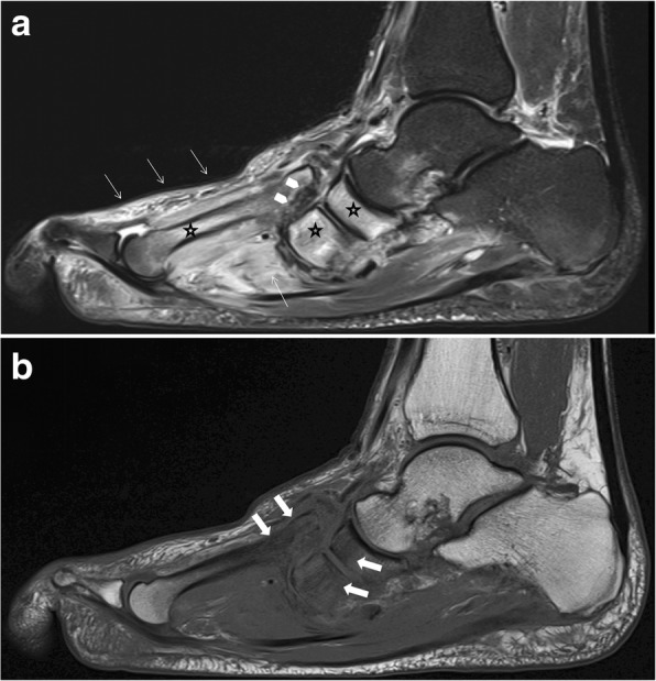 Fig. 15