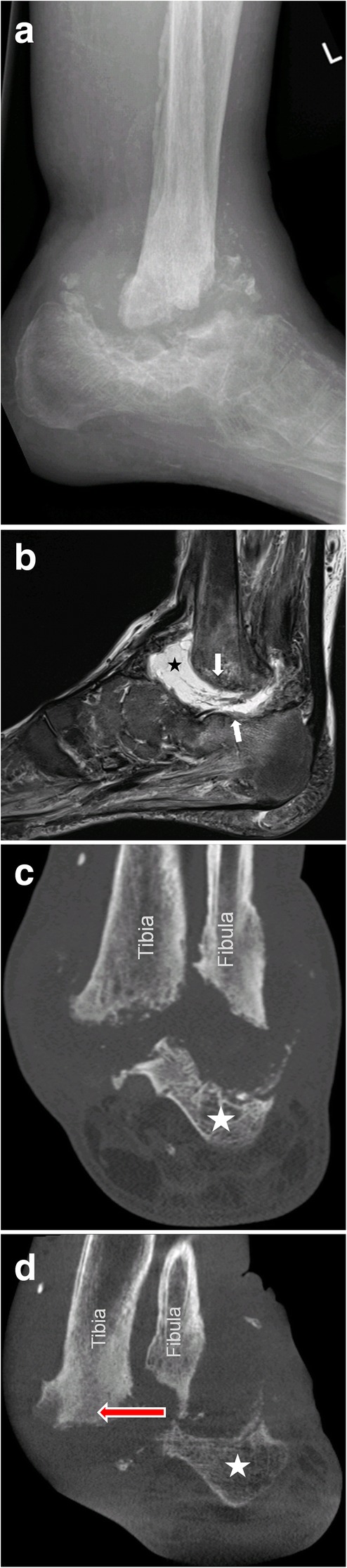 Fig. 18