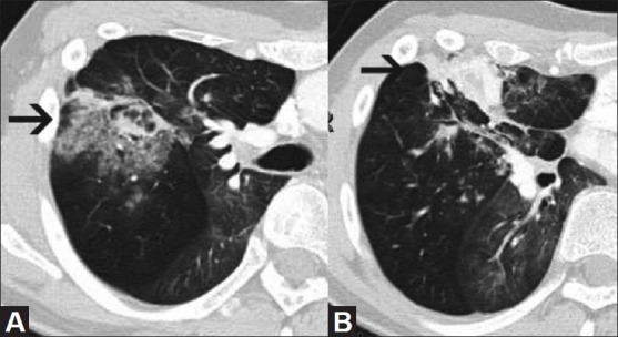 Figure 1(A, B)