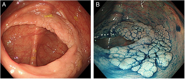 Figure 1