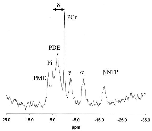 Fig 2.