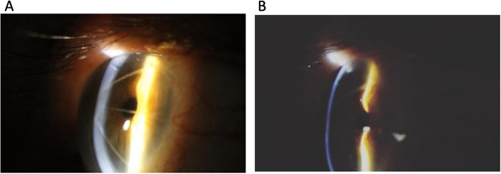 Fig. 1