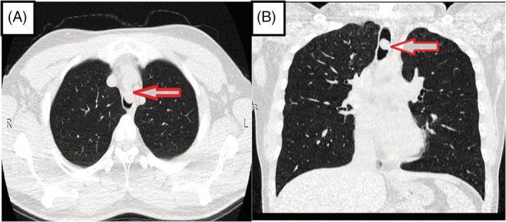 FIGURE 1