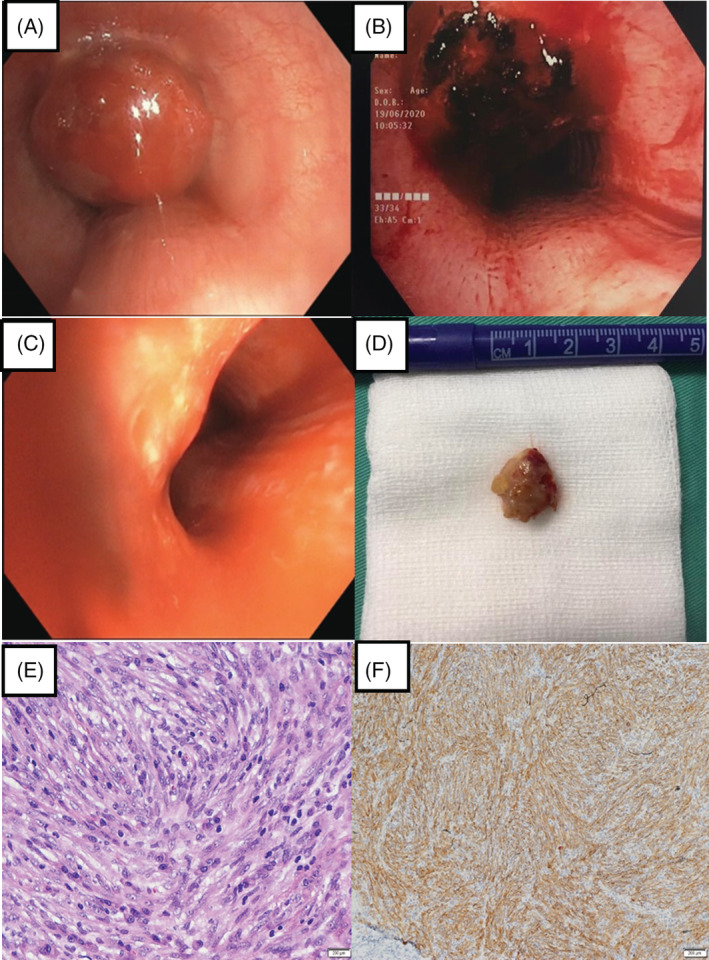 FIGURE 2