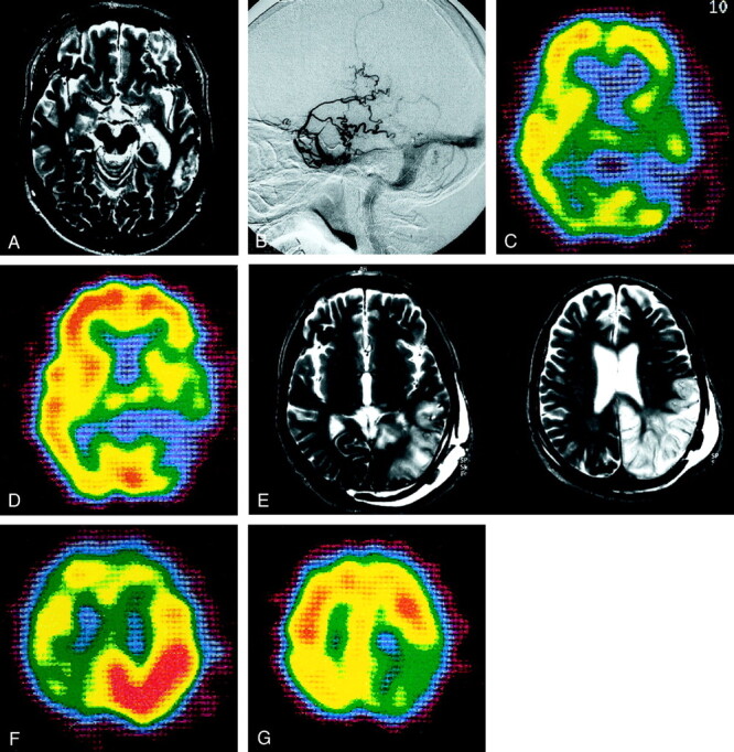 Fig 3.