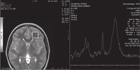 Figure 1b