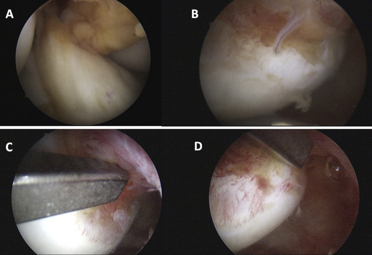 Fig. 4