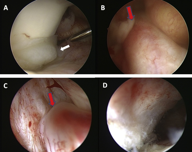 Fig. 1