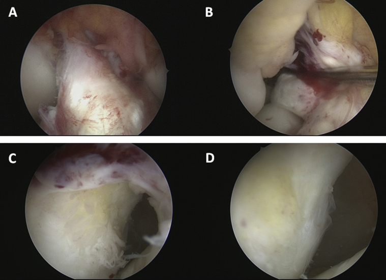 Fig. 3