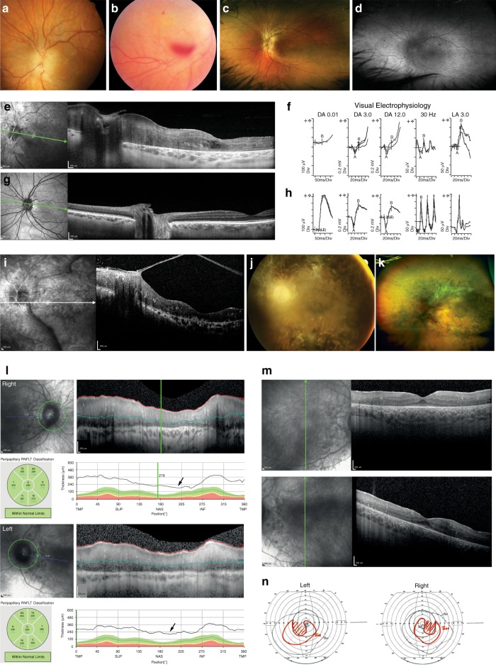 Fig. 2