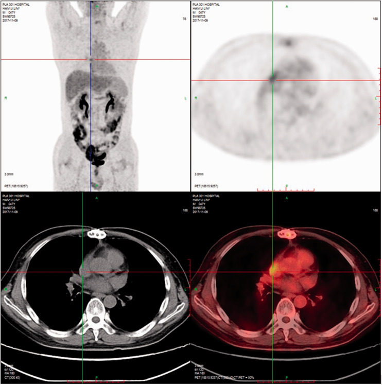 Figure 2.