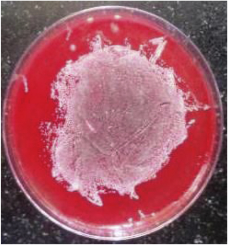 Fig. 1