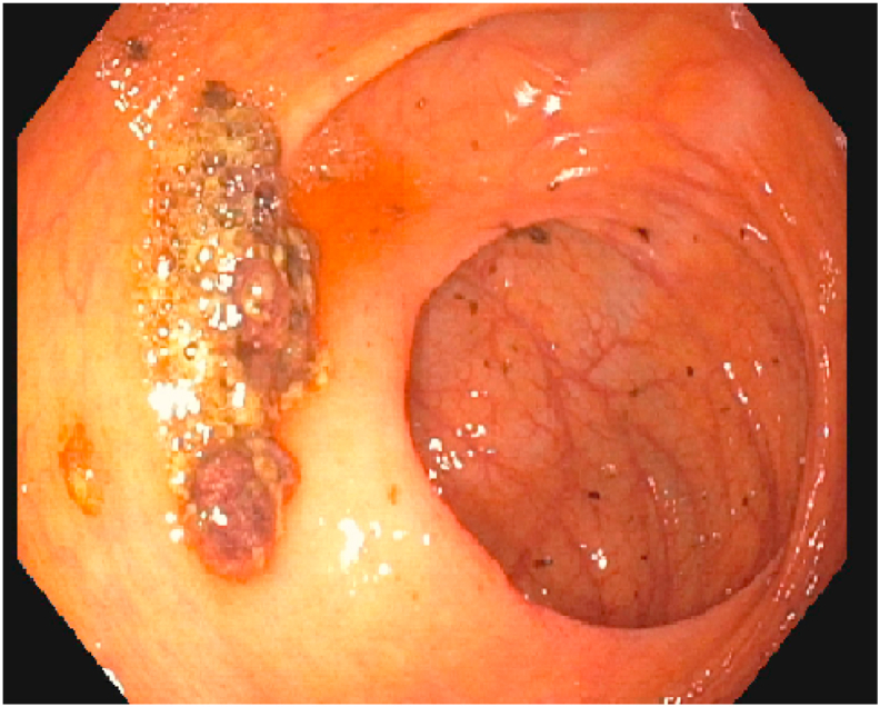 Fig. 1