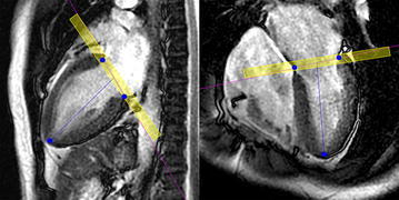 Fig. 2