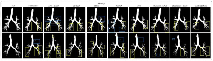 Figure 16