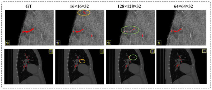 Figure 14