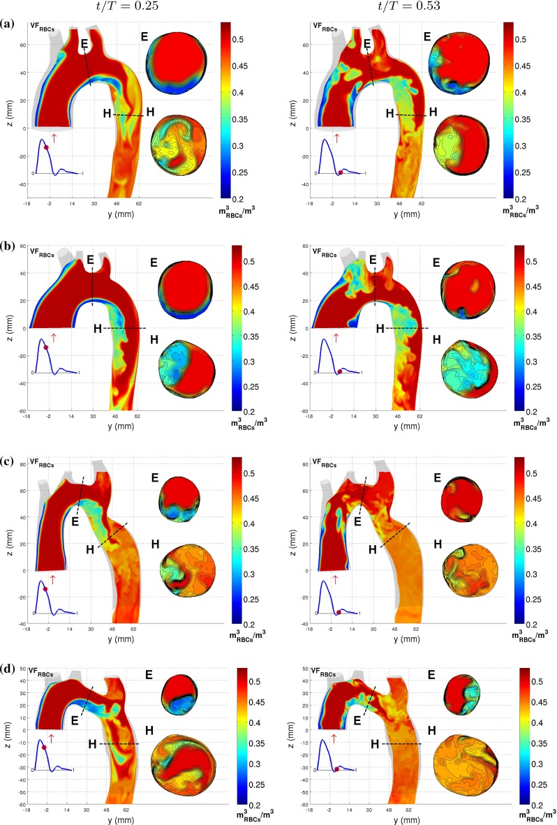 Fig. 11