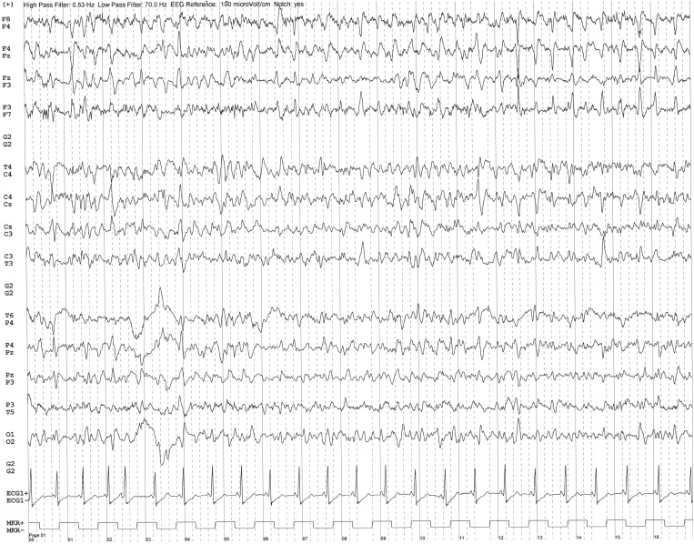 Fig. 1a