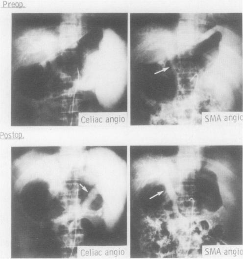 FIG. 5.