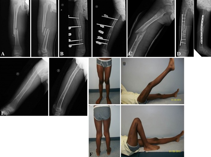 Fig. 1A–F