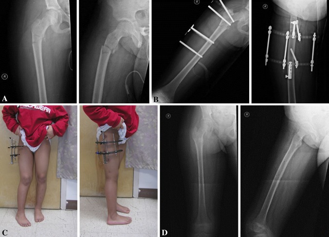 Fig. 2A–D