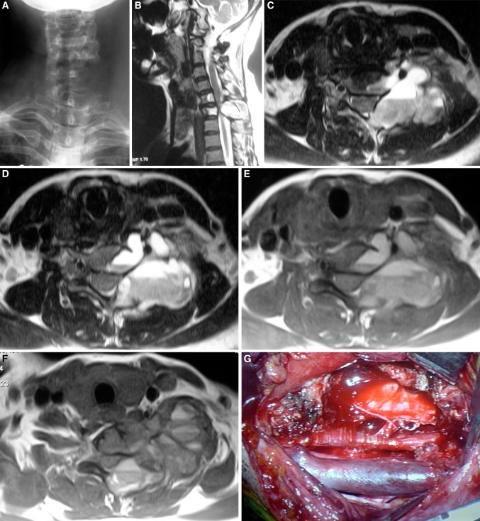 Fig. 3