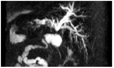 Figure 1 -