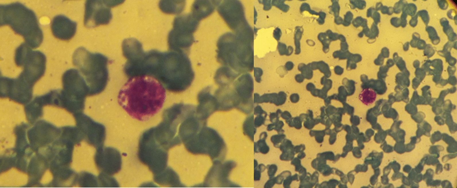 Fig. 1