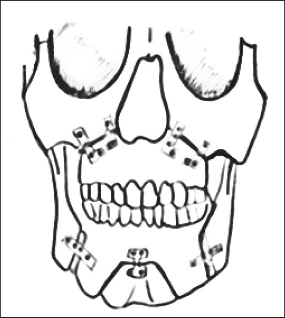 Figure 3A