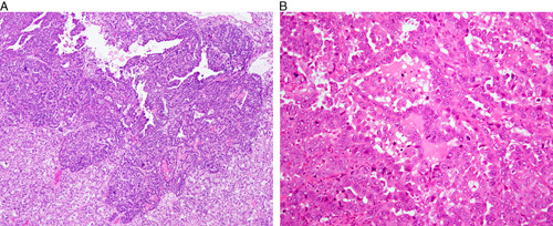 FIG. 8