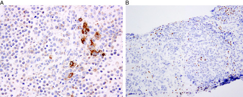 FIG. 10