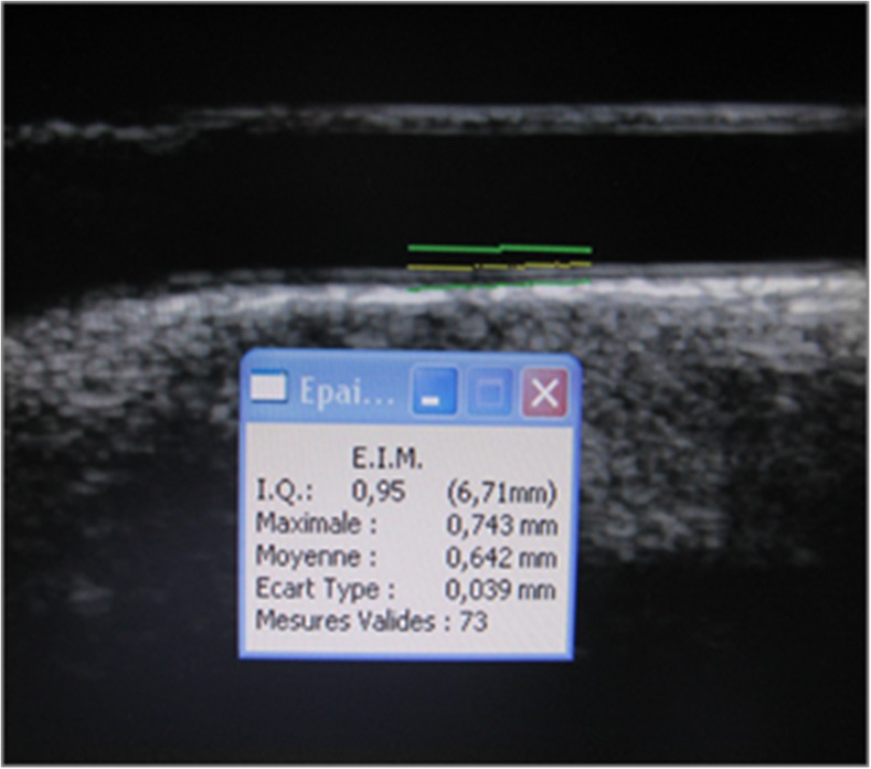 Fig. 1