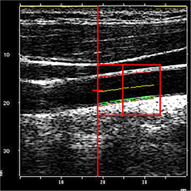 Fig. 2