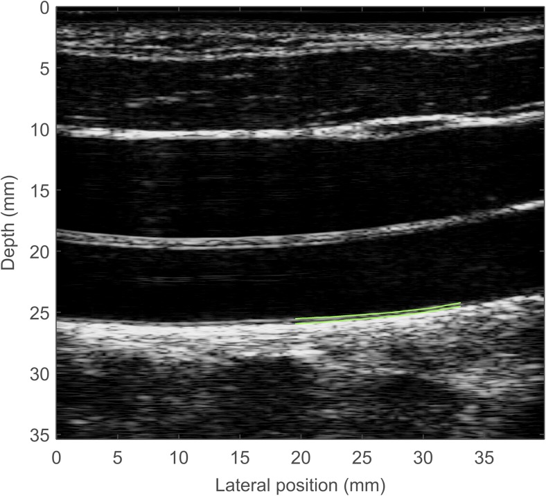 Fig. 3