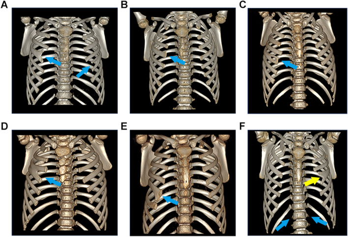 Fig. 1