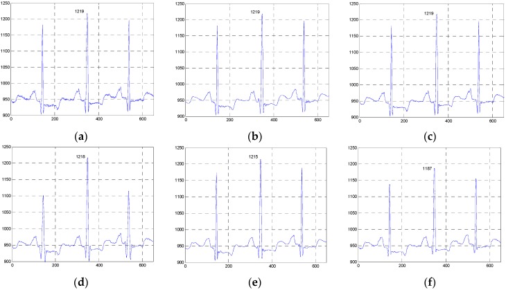 Figure 11