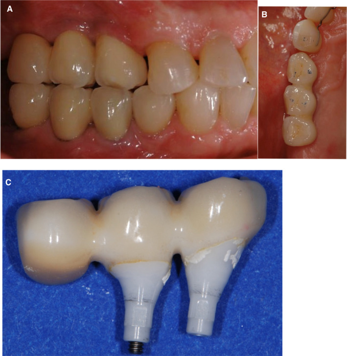 FIGURE 3